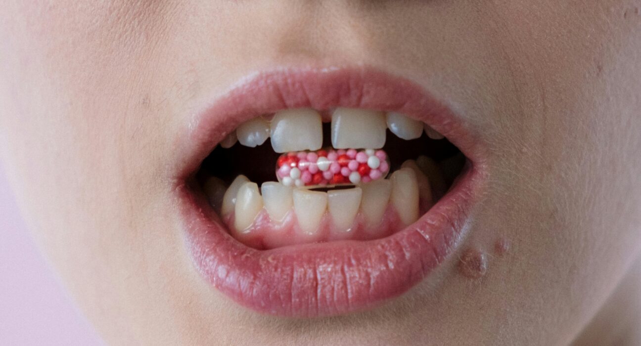 Gum Disease: Causes, Symptoms